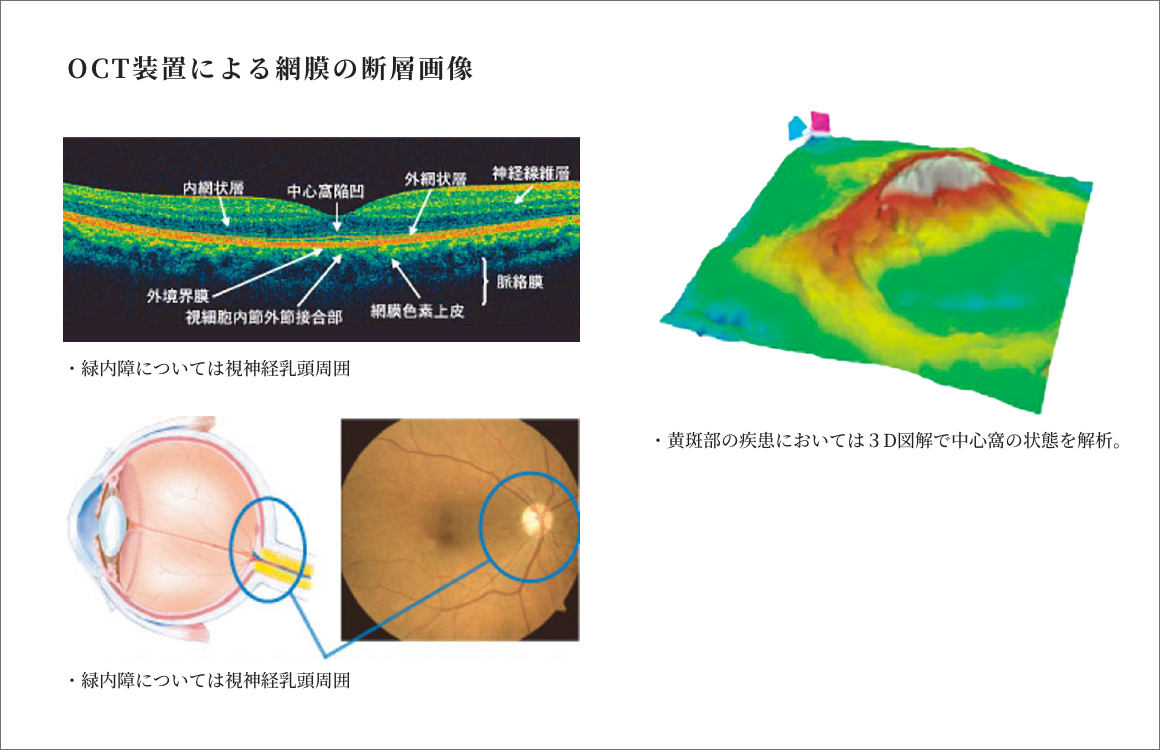OCT装置による網膜の断層画像