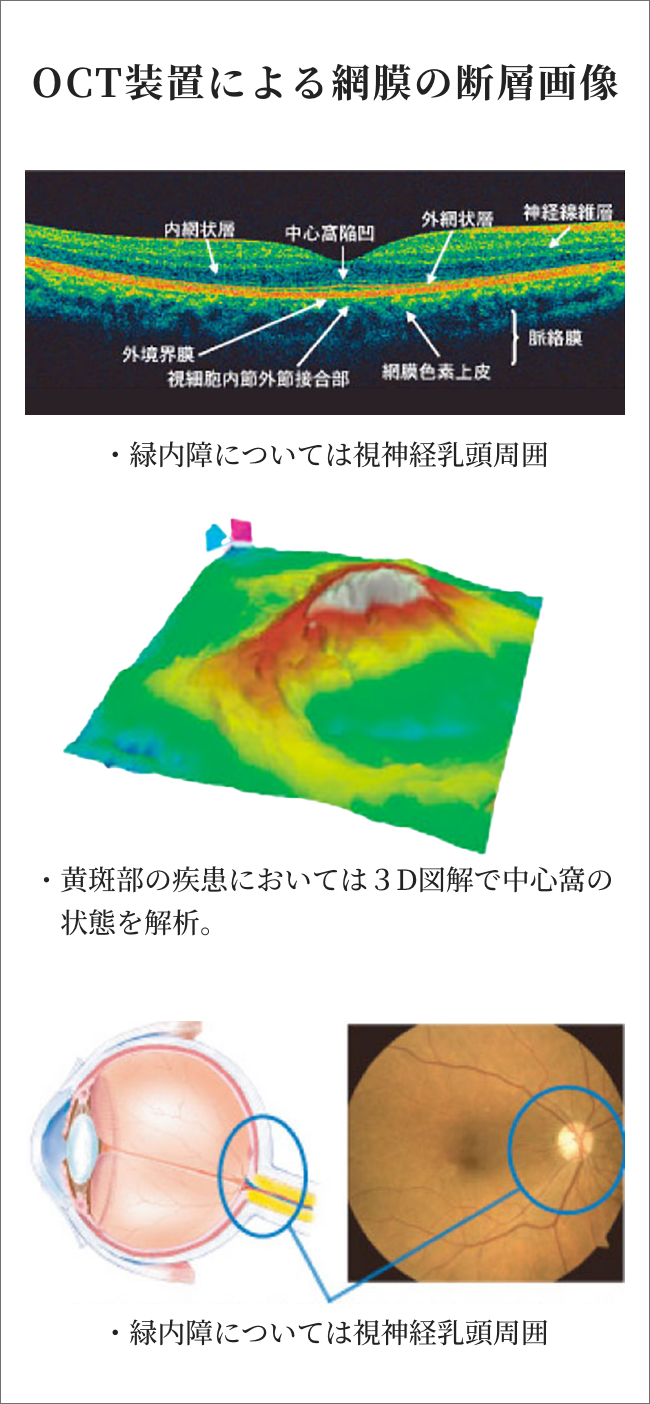 OCT装置による網膜の断層画像